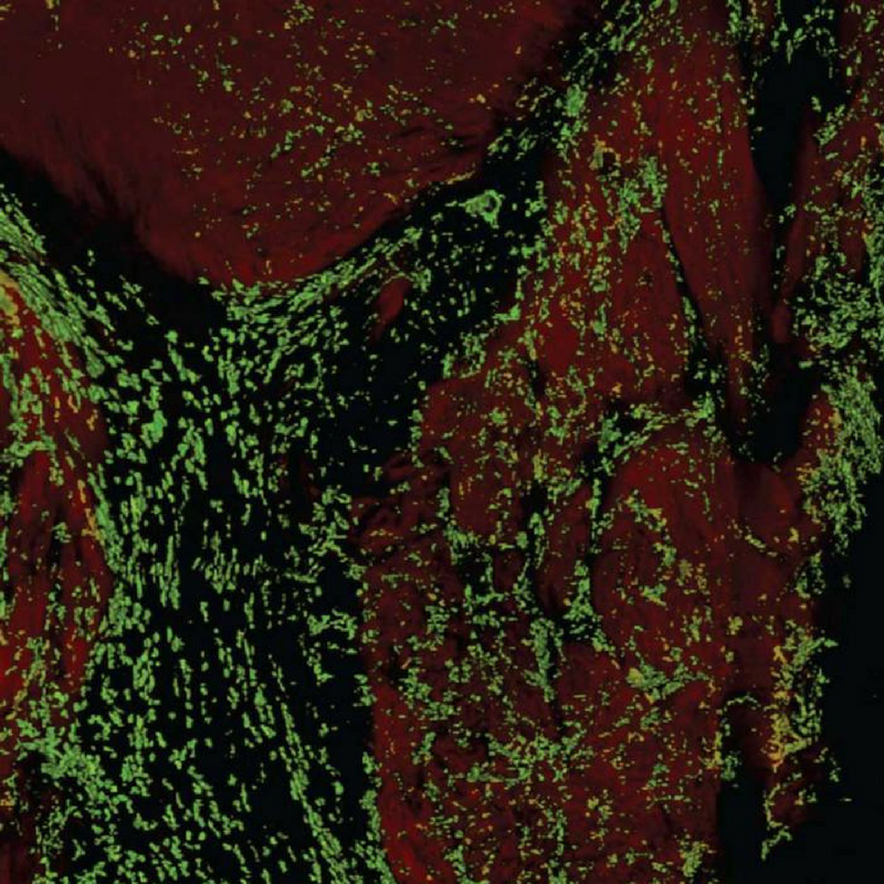 Heart cells (red) and macrophages (green) in a human atrioventricular node. 
Credit: Maarten Hulsmans & Matthias Nahrendorf
