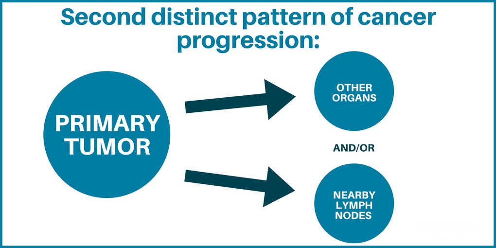 Lymph node graphic 2
